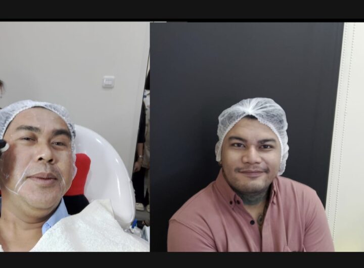 Dika Ogah dan Rey Savero Saat Perawatan di Klinik Dr. Hanna